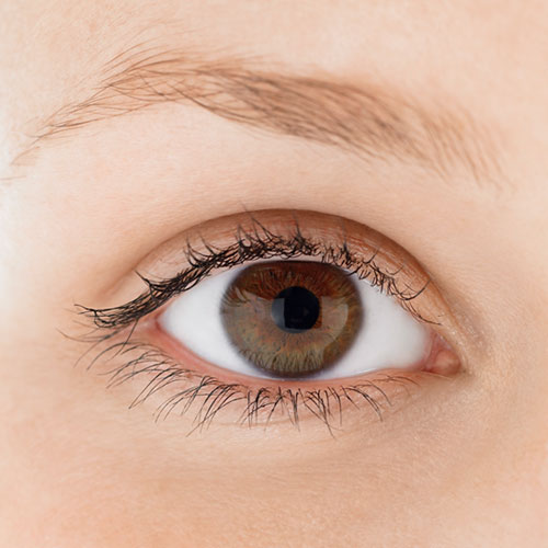 Eyelid Surgery Brisbane Ectropion / Entropion